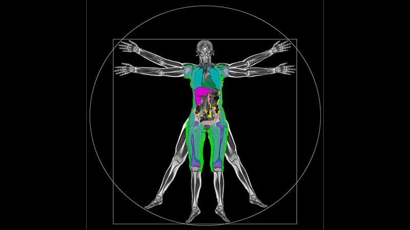 Deep MRI scan of human body with colourful highlights that phenotyping enhances our ability to understand health and disease development