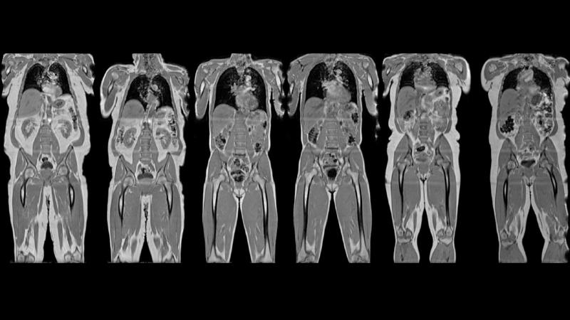 MRI Scans from ageing study